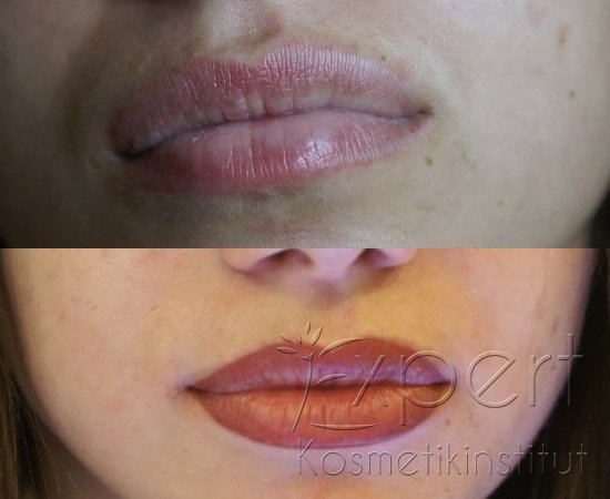 Permanent Make-up Lippen in Berlin Foto 2