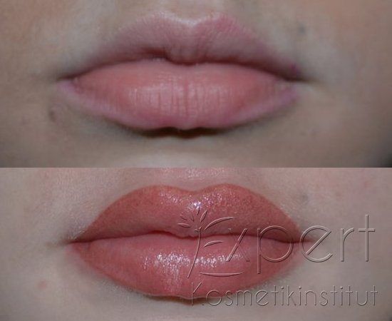 Permanent Make-up Lippen in Berlin Vorher-Nachher-Bild 4