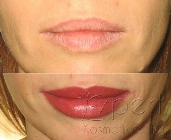 Permanent Make-up Lippen in Berlin Vorher-Nachher-Bild 3
